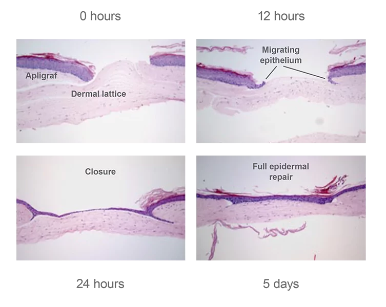 Slides from an in vitro study demonstrating how the living cells of Apligraf are bioactive and poised to heal