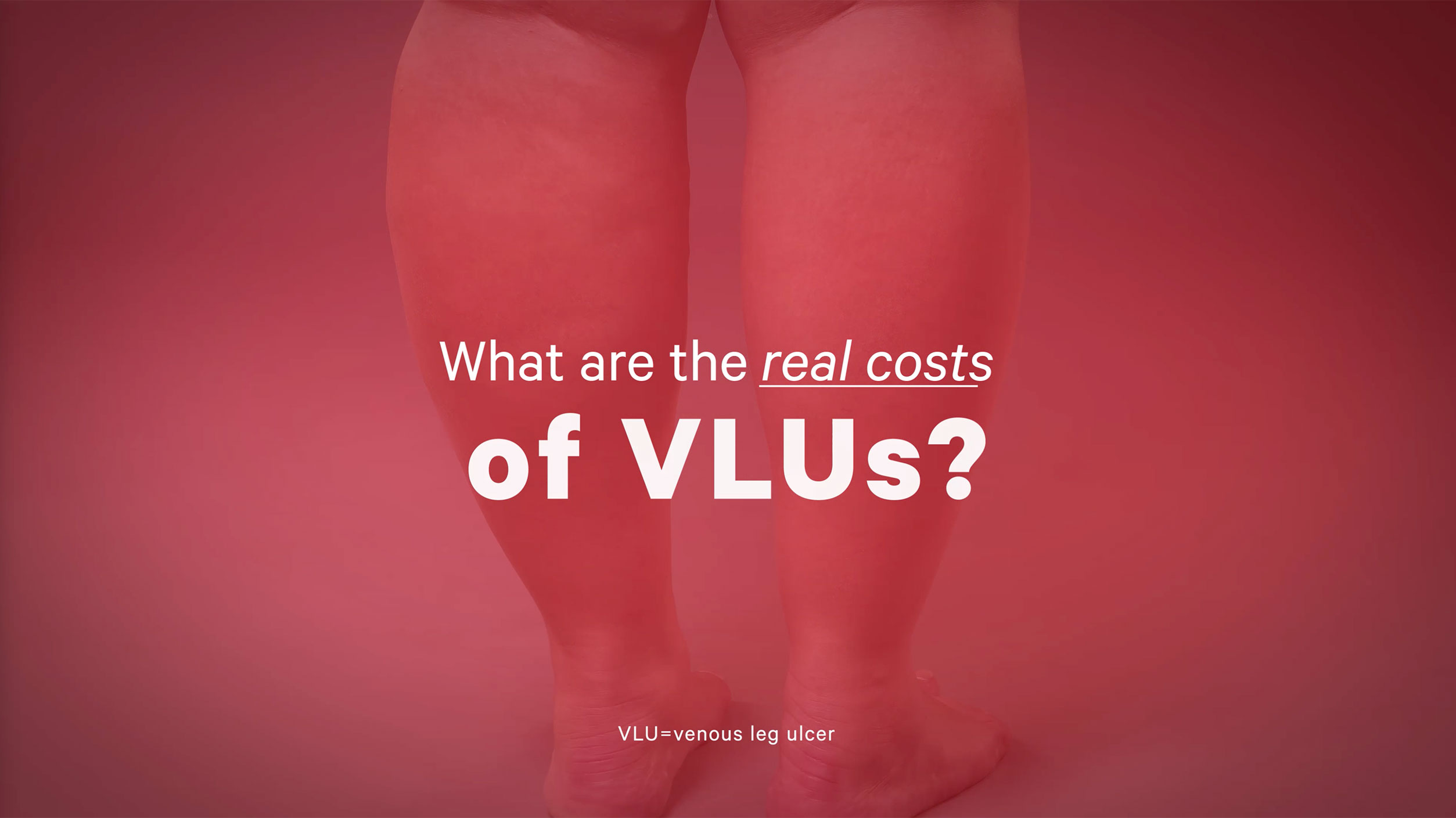Video on the real costs of VLUs